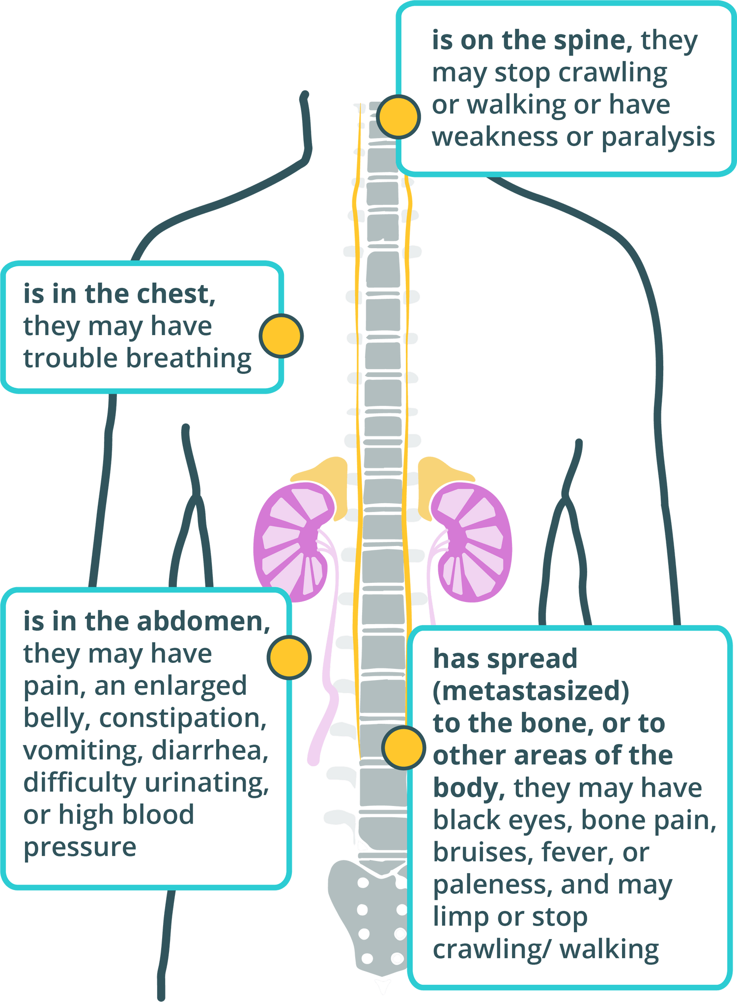 is on the spine, they may stop crawling or walking or have weakness or paralysis. If a child has a tumor that is in the chest, they may have trouble breathing. If a child has a tumor that is in the abdomen, they may have pain, an enlarged belly, constipation, vomiting, diarrhea, difficulty urinating, or high blood pressure. If a child has a tumor that has spread (metastasized) to the bone, or to other areas of the body, they may have black eyes, bone pain, bruises, fever, or paleness, and may limp or stop crawling or walking.